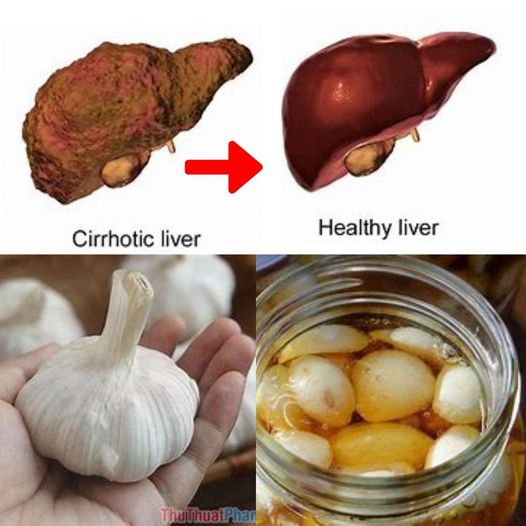 Improved Blog Post: Garlic and Liver Health