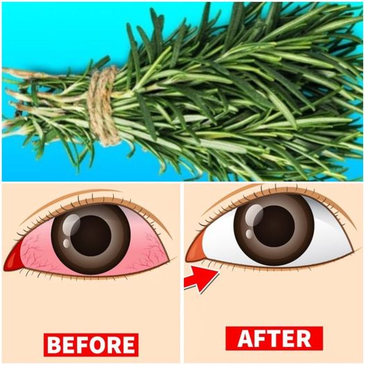 7 Herbs to Boost Your Eye Health