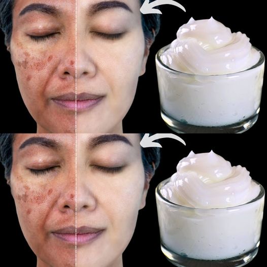 Milk and Cornstarch: A Fountain of Youth in a Bowl?