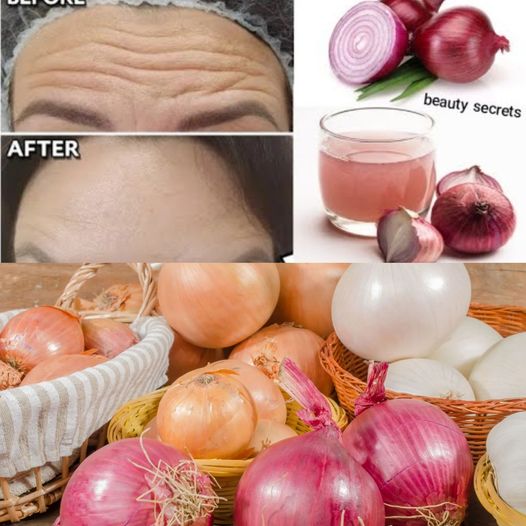 1 onion is a million times stronger than Botox, onion juice for skin wrinkles,🧅onion for face