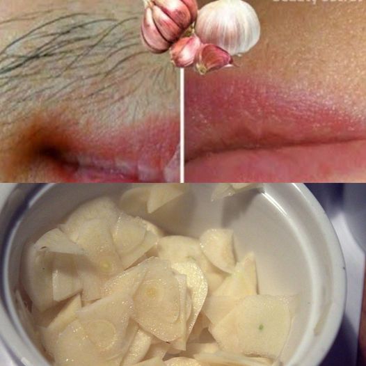 Recipe: Permanent Hair Removal Elixir