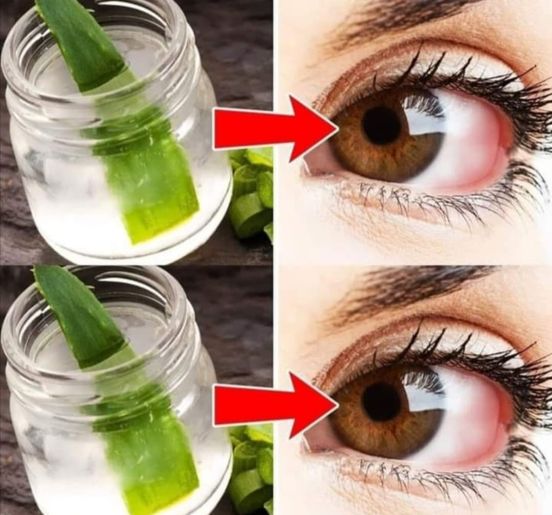 Recipe for Better Vision Without Glasses