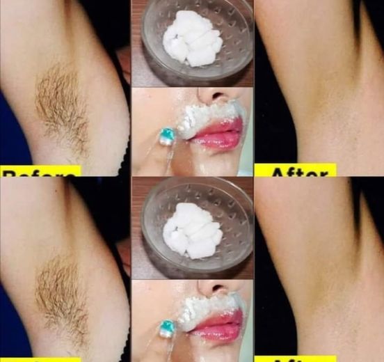 Stop Shaving! Gentle and Effective Pubic Hair Removal
