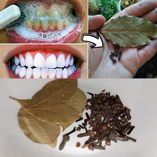 Secret Recipe: Remove Tartar and Whiten Teeth in Just 2 Minutes!