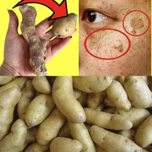 DIY Potato and Ginger Mask for Dark Spots