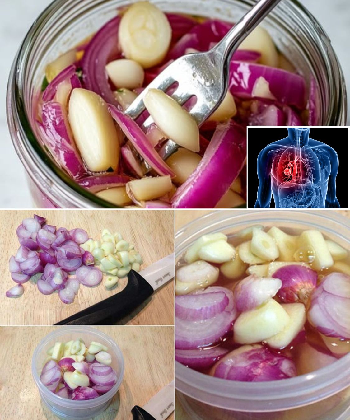 Recipe for Red Onion, Garlic, and Honey to Treat Lungs, Cough, and Colds