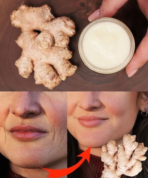 The Power of Ginger: A Natural Alternative to Botox?