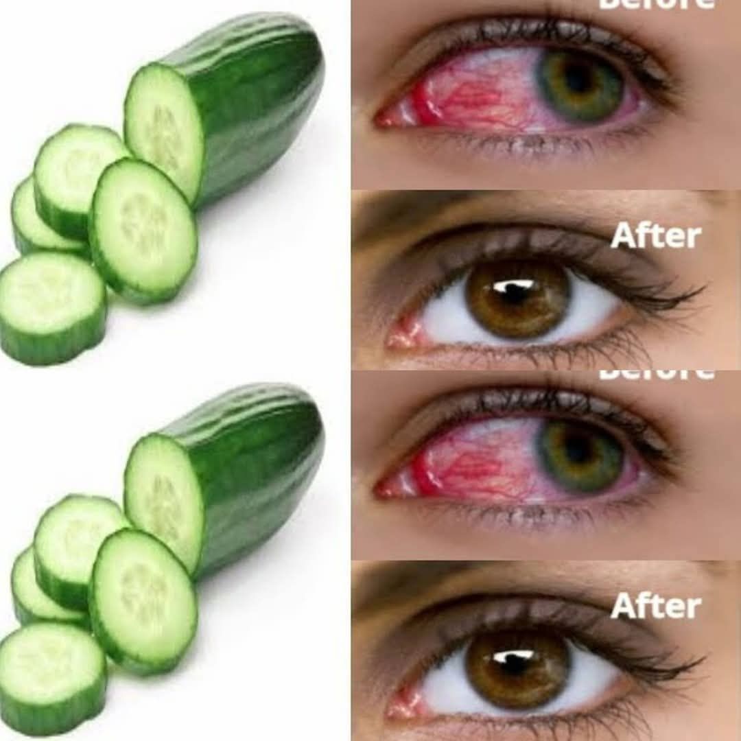 A Spoon a Day for Stronger Vision: A Natural Remedy for Eye Health