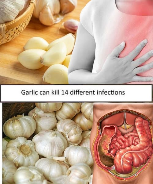 Garlic can kill 14 different infections I bet you didn’t know about.