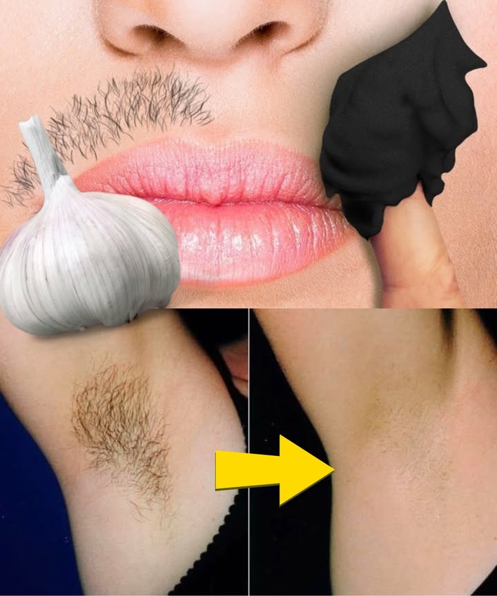 Stop Shaving! Here’s How to Naturally & Permanently Reduce Facial, Body, and Pubic Hair