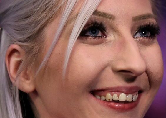 Tears on the Oche – Fallon Sherrock Opens Up About the Struggles Behind Her Success